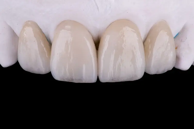 セラミックの作製