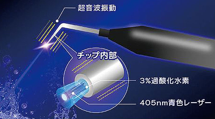 超音波振動