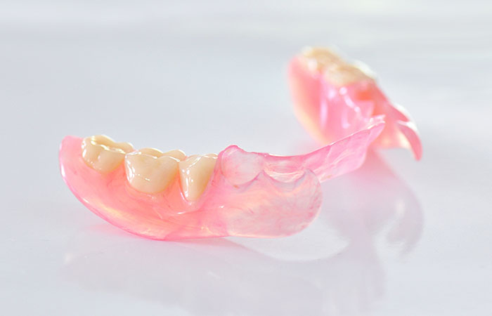 インプラントオーバーデンチャー