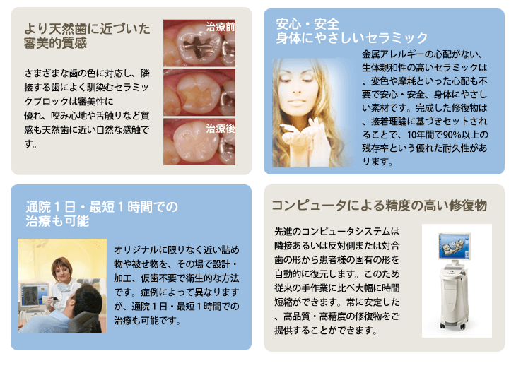 セレックの詳細