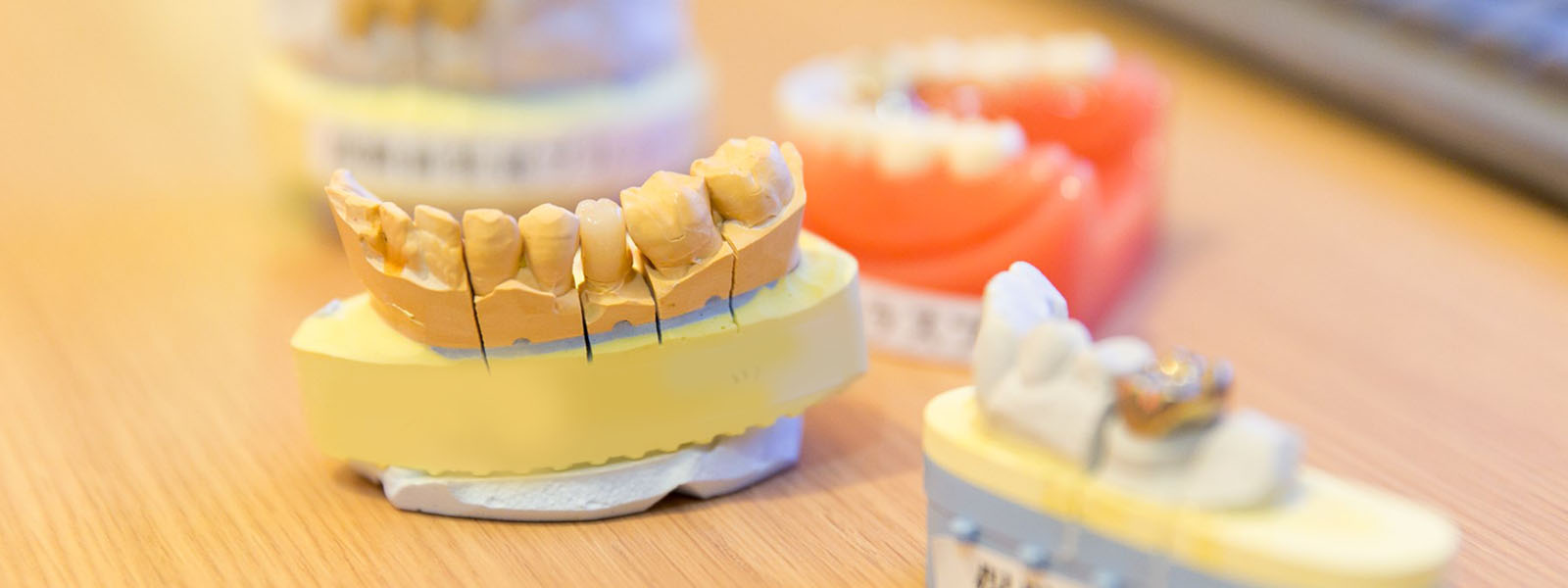 セラミック症例集