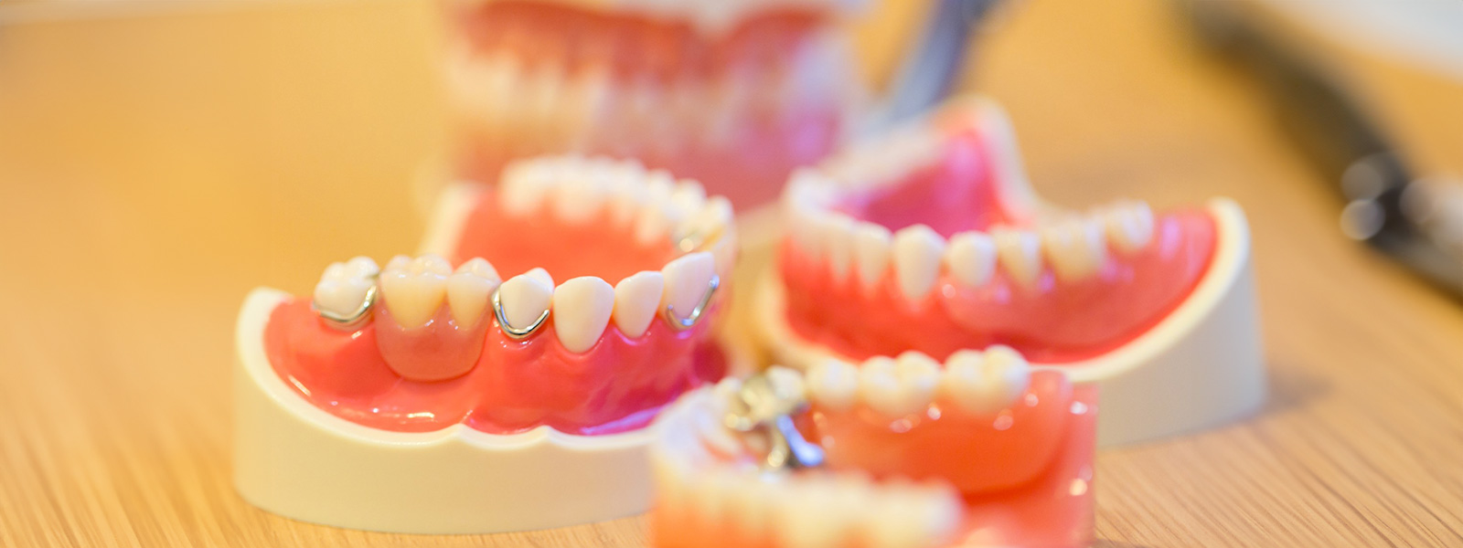 入れ歯・義歯症例集