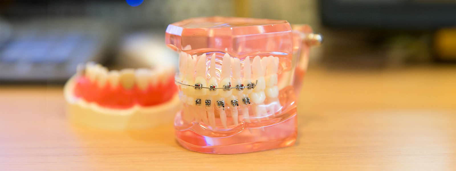 矯正歯科症例集