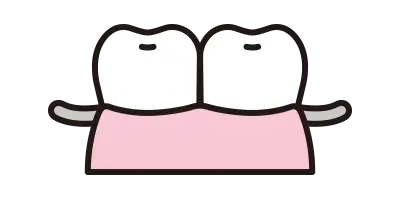 入れ歯（義歯）