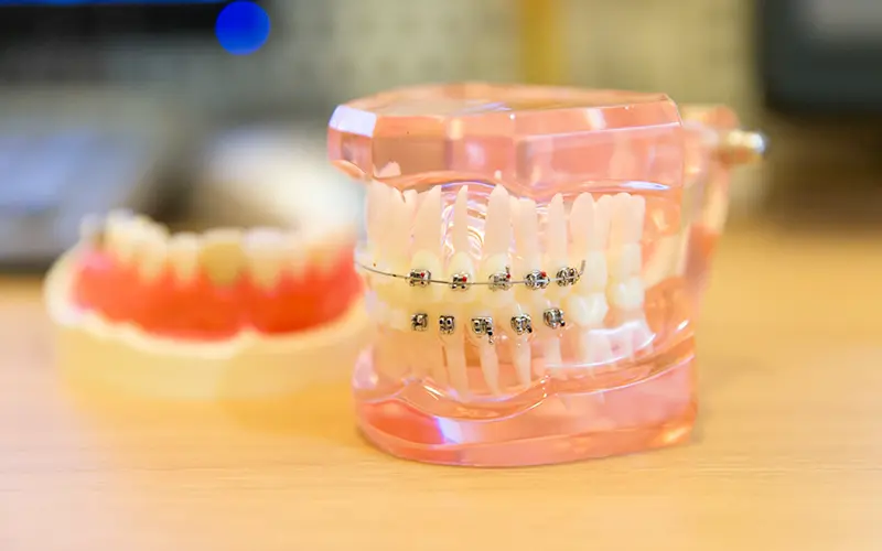 矯正歯科