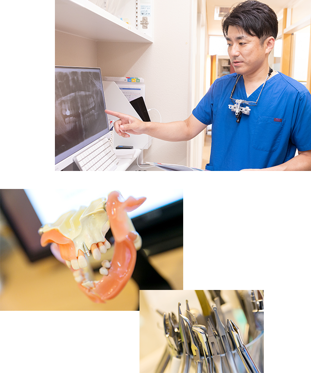 インプラント治療