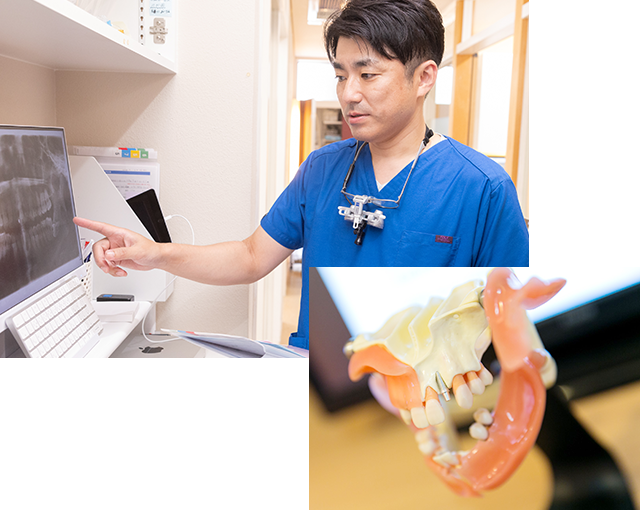 インプラント治療