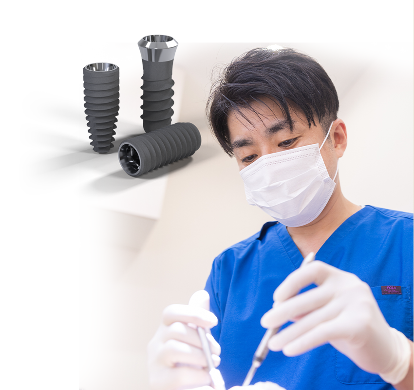 伊丹市 インプラント