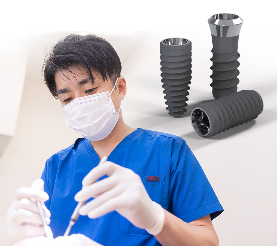 伊丹市 インプラント