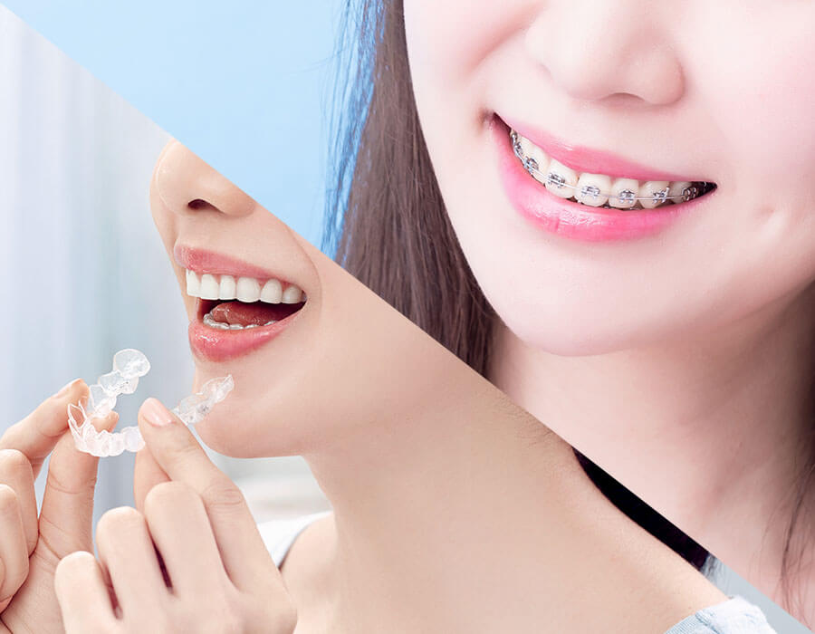 虫歯や歯周病のリスクが低く健康的