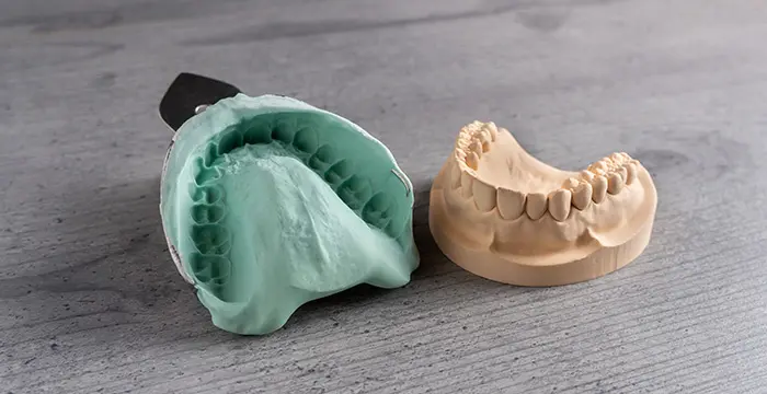 歯型採取